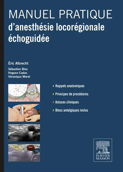 Manuel pratique d'anesthésie locorégionale échoguidée et des blocs antalgiques associés