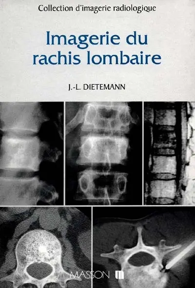 Imagerie du rachis lombaire