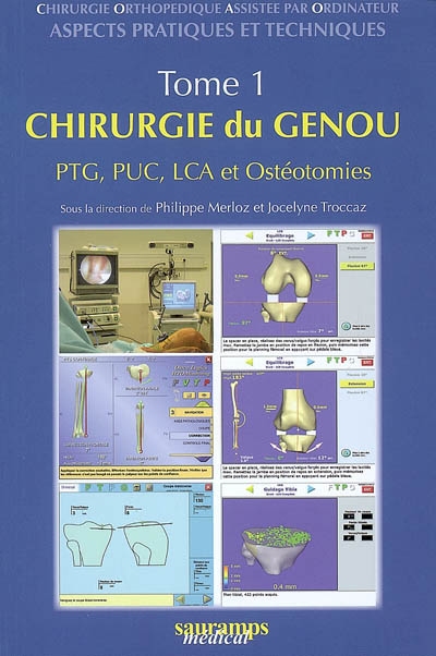 Chirurgie orthopédique assistée par ordinateur : aspects pratiques et techniques. Vol. 1. Chirurgie du genou : PTG, PUC, LCA et ostéotomies