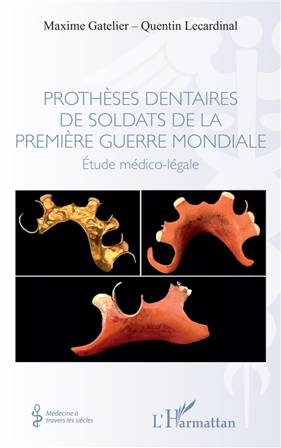 Prothèses dentaires de soldats de la Première Guerre mondiale : étude médico-légale