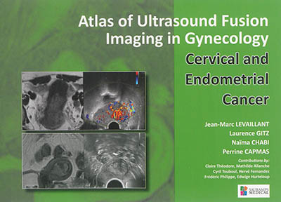 Atlas of ultrasound fusion imaging in gynecology : cervical and endometrial cancer