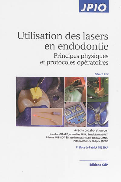 Utilisation des lasers en endodontie : principes physiques et protocoles opératoires