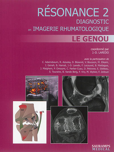 Résonance : diagnostic en imagerie rhumatologique. Vol. 2. Le genou