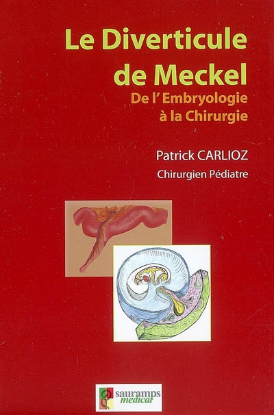 Le diverticule de Meckel : de l'embryologie à la chirurgie : a propos d'une série personnelle de 217 cas pédiatriques et d'une méta-analyse de 8.389 cas