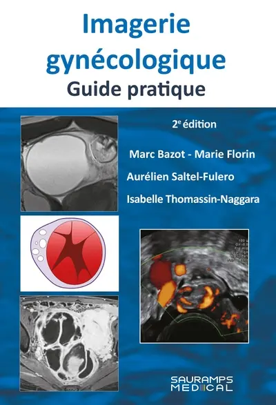 Imagerie gynécologique : guide pratique