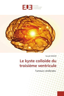 Le kyste colloïde du...