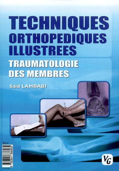 Techniques orthopédiques illustrées : traumatologie des membres