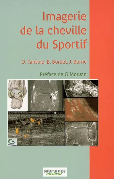 Imagerie de la cheville du sportif