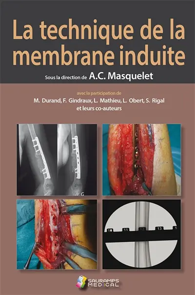 La technique de la membrane induite : principes, pratiques et perspectives La technique de la membrane induite : principes, pratiques et perspectives