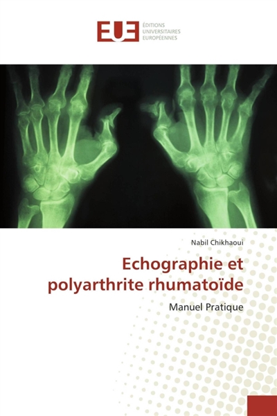 Echographie et polyarthrite...