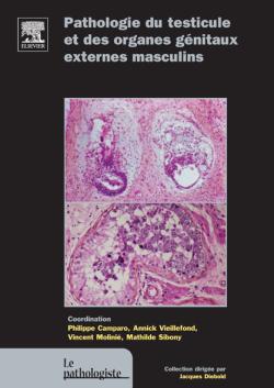 Pathologie du testicule et des organes génitaux externes masculins