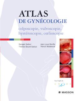 Atlas de gynécologie : colposcopie, vulvoscopie, hystéroscopie, coelioscopie