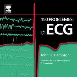 150 problèmes d'ECG