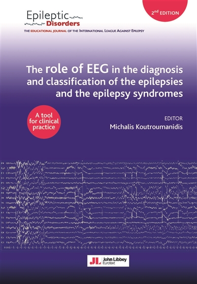 The role of EEG in the diagnosis and classification of the epilepsies and the epilepsy syndromes : a tool for clinical practice