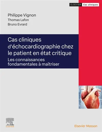 Cas critique d'échocardiographie chez le patient en état critique : les connaissances fondamentales à maîtriser