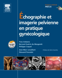 Echographie et imagerie pelvienne en pratique gynécologique