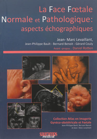 La face foetale normale et pathologique : aspects échographiques