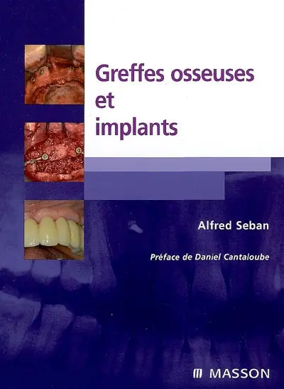 Greffes osseuses et implants