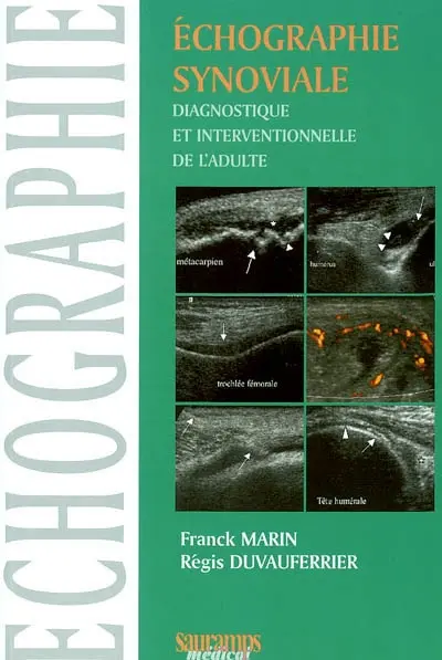Echographie synoviale diagnostique et interventionnelle de l'adulte