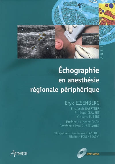 Echographie en anesthésie régionale périphérique