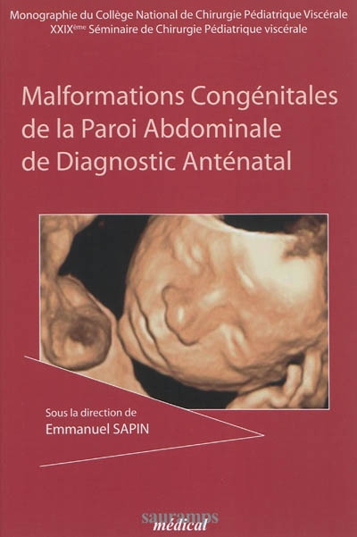 Malformations congénitales de la paroi abdominale de diagnostic anténatal
