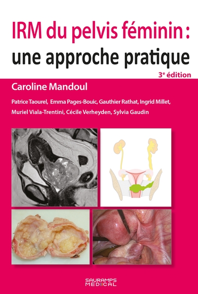 IRM du pelvis féminin : une...