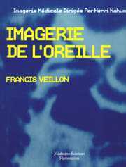 Imagerie de l'oreille