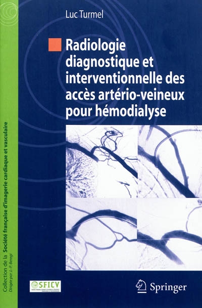 Radiologie diagnostique et interventionnelle des accès artério-veineux pour hémodialyse
