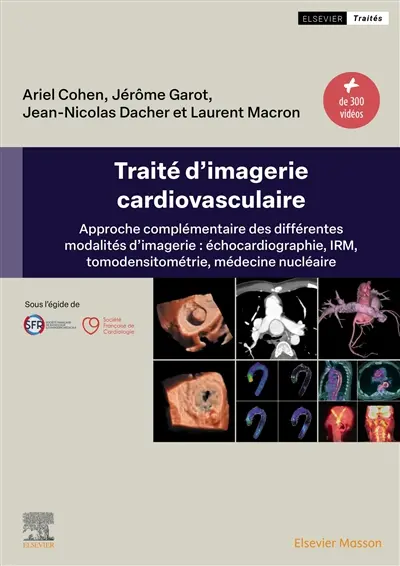Traité d'imagerie cardiovasculaire : approche complémentaire des différentes modalités d'imagerie : échocardiographie, IRM, tomodensitométrie, médecine nucléaire