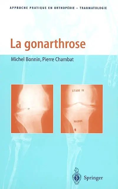 La gonarthrose