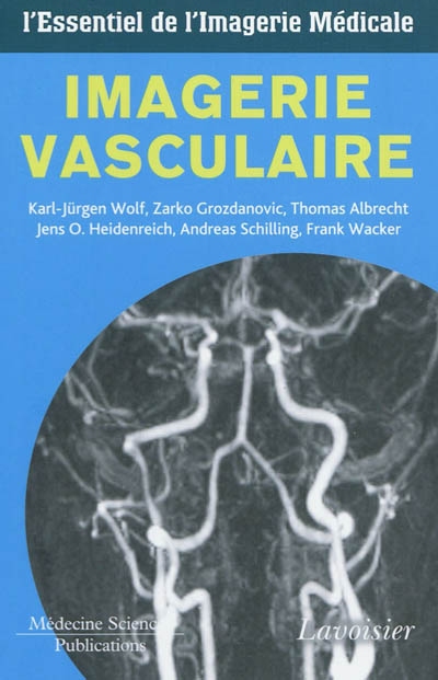 Imagerie vasculaire