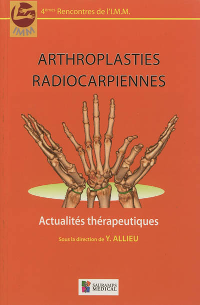 Arthroplasties radiocarpiennes : actualités thérapeutiques