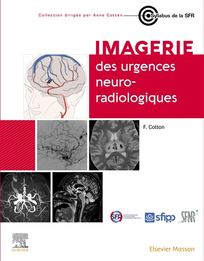 Imagerie des urgences neuroradiologiques