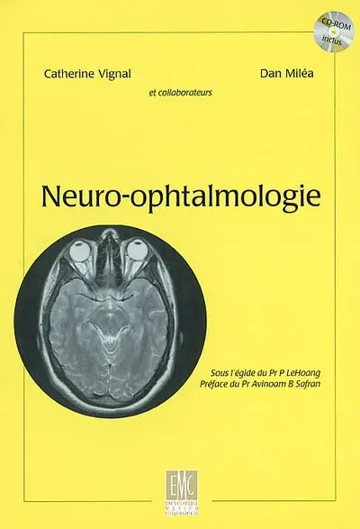 Neuro-ophtalmologie