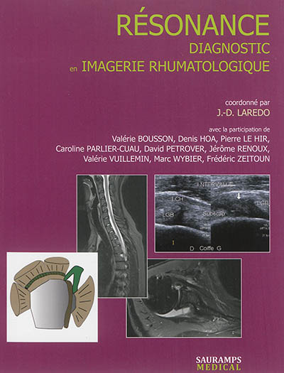 Résonance : diagnostic en imagerie rhumatologique