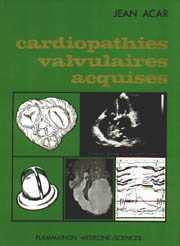 Les Cardiopathies valvulaires acquises